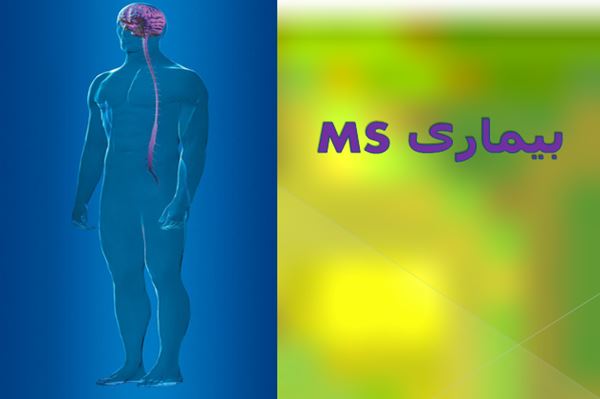 پاورپوینت بیماری MS