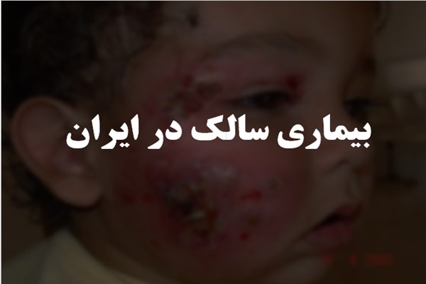 پاورپوینت بیماری سالک در ایران