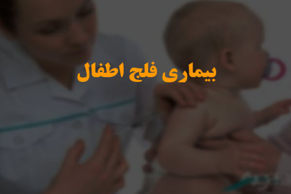 پاورپوینت بیماری فلج اطفال